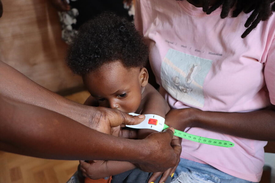UNHAS flights allow thousands of humanitarian workers to reach vulnerable people - like this child, in northern Haiti, who shows signs of severe malnourishment. WFP/Alexis Masciarelli